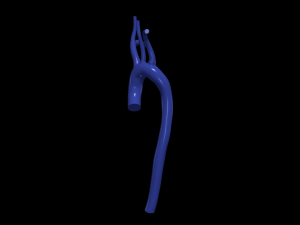 Aorta 3D 모델