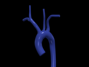 Aorta 3D 모델