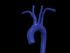 Aorta 3D Model
