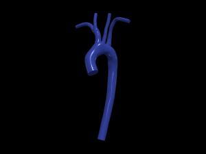 Aorta 3D 모델