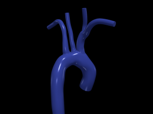 Aorta 3D 모델
