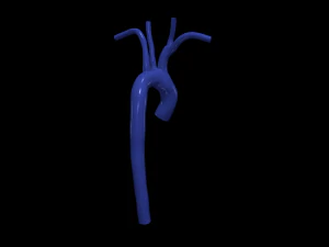 Aorta 3D Modell