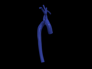 Aorta 3D 모델