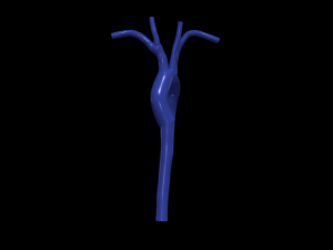 Aorta 3D 모델
