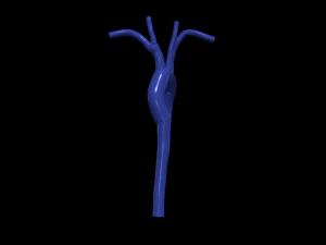 Aorta 3D Modell