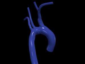 Aorta 3D 모델