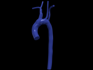Aorta 3D 모델