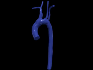 Aorta 3D Model