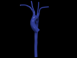 Aorta 3D 모델
