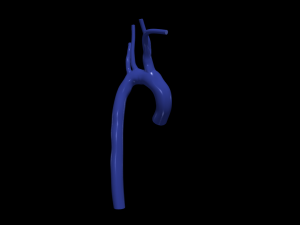 Aorta 3D 모델
