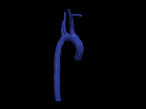 Aorta 3D Model
