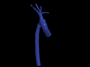 Aorta 3D 모델