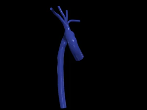 Aorta 3D Model