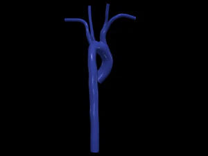 Aorta 3D Model