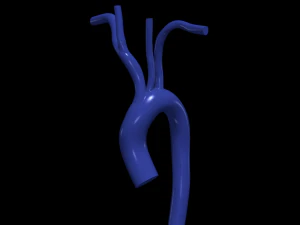 Aorta 3D Modell