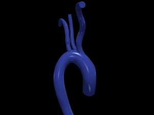 Aorta 3D 모델