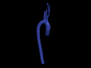 Aorta 3D 모델
