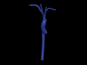 Aorta 3D 모델