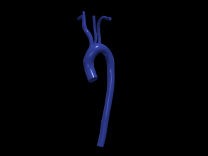Aorta 3D 모델