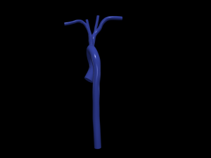 Aorta 3D 모델
