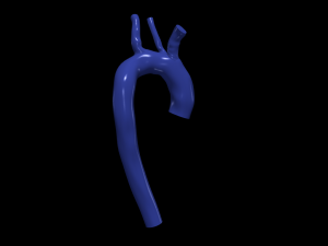 Aorta 3D Model
