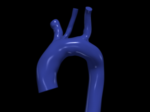 Aorta 3D 모델