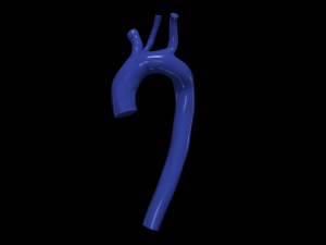 Aorta 3D 모델