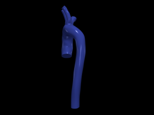 Aorta 3D 모델