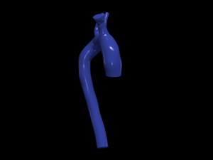 Aorta 3D 모델