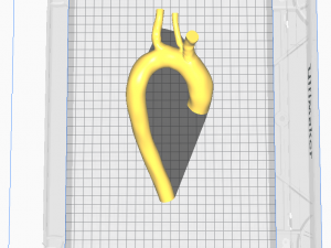 Aorta 3D 모델