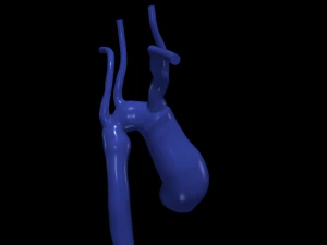 aorta Model 3D