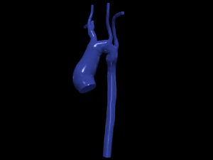 aorta Model 3D