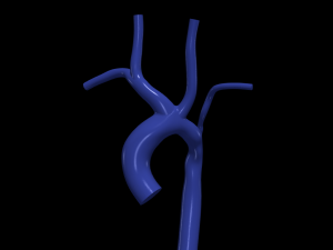 Aorta 3D Model
