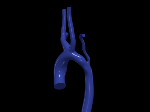 Aorta 3D-Modell