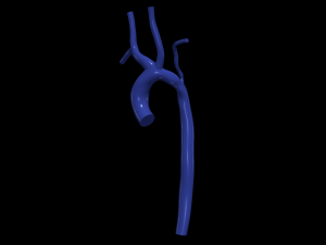 Aorta 3D-Modell