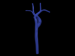 Aorta 3D-Modell