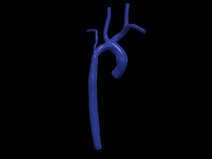 Aorta 3D-Modell