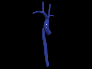 Aorta 3D-Modell
