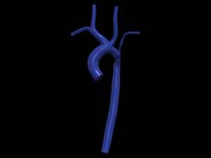 Aorta 3D-Modell