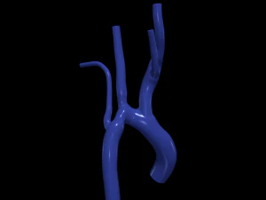 aorta Model 3D