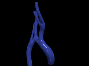 Aorta Modello 3D