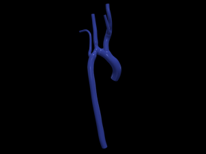 Aorta Modello 3D