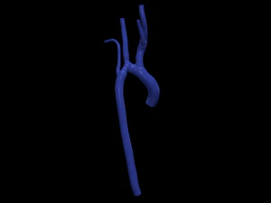 aorta Model 3D