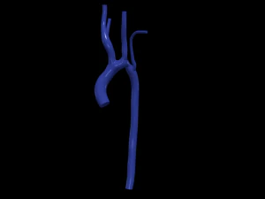 aorta Model 3D