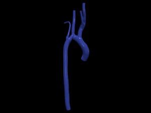 aorta Model 3D