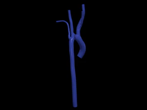 aorta Model 3D