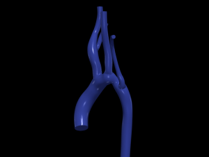 Aorta Modello 3D