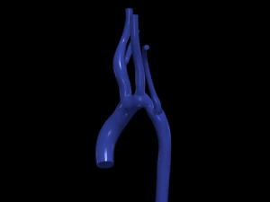 aorta Model 3D