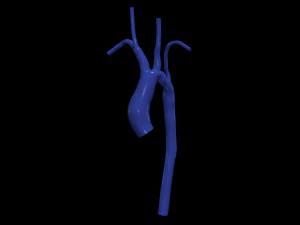 Aorte Modèle 3D
