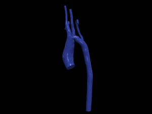 Aorte Modèle 3D